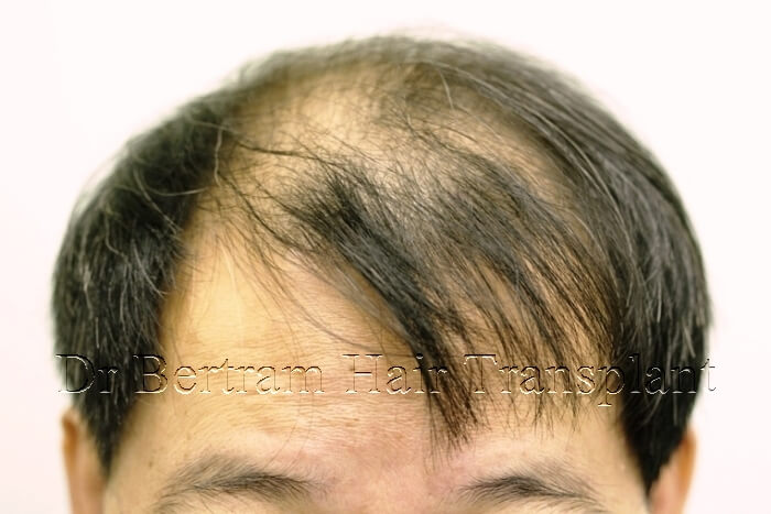 臨床個案:50歲男性