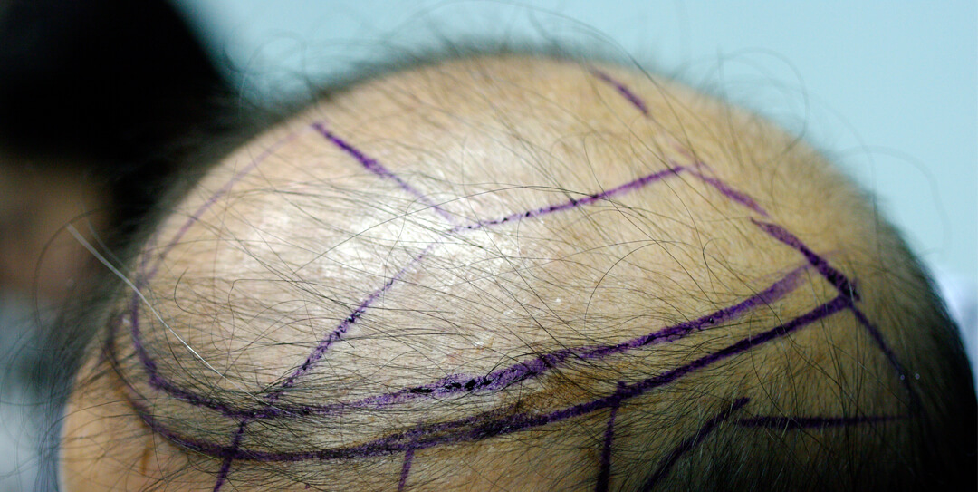 手術考慮因素